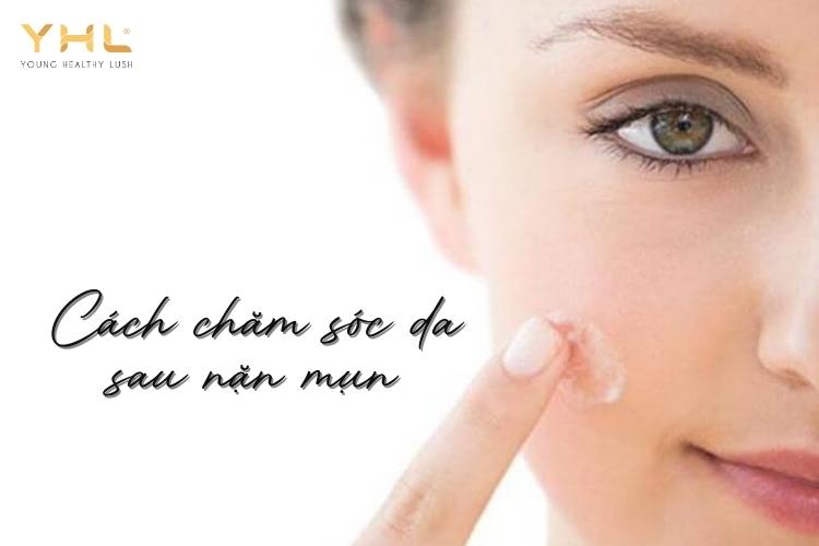 Chăm sóc da sau nặn mụn như thế nào để hạn chế vết thâm?