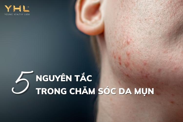 5 nguyên tắc quan trọng trong quy trình chăm sóc da mụn