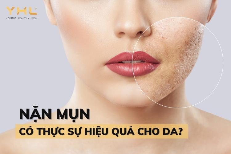 Nặn mụn có thực sự hiệu quả đối với làn da không?