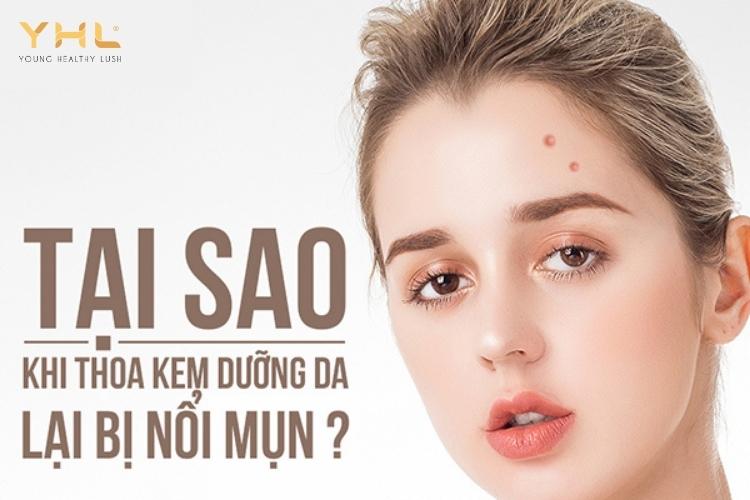 7 sai lầm khiến bạn dùng kem dưỡng ẩm bị nổi mụn